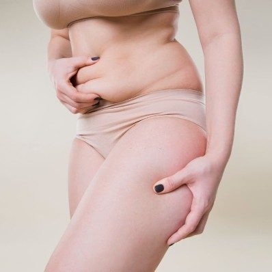 Prices - Fat, Cellulite & Tightening Solutions