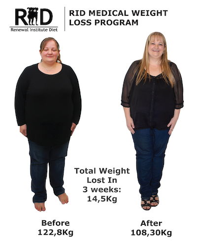 Rid Before And After Renewal Institute Diet Medical Hcg Weight Loss Female 26