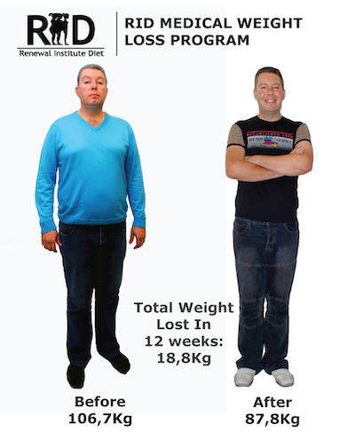 Rid Before And After Renewal Institute Diet Medical Hcg Weight Loss Male 19
