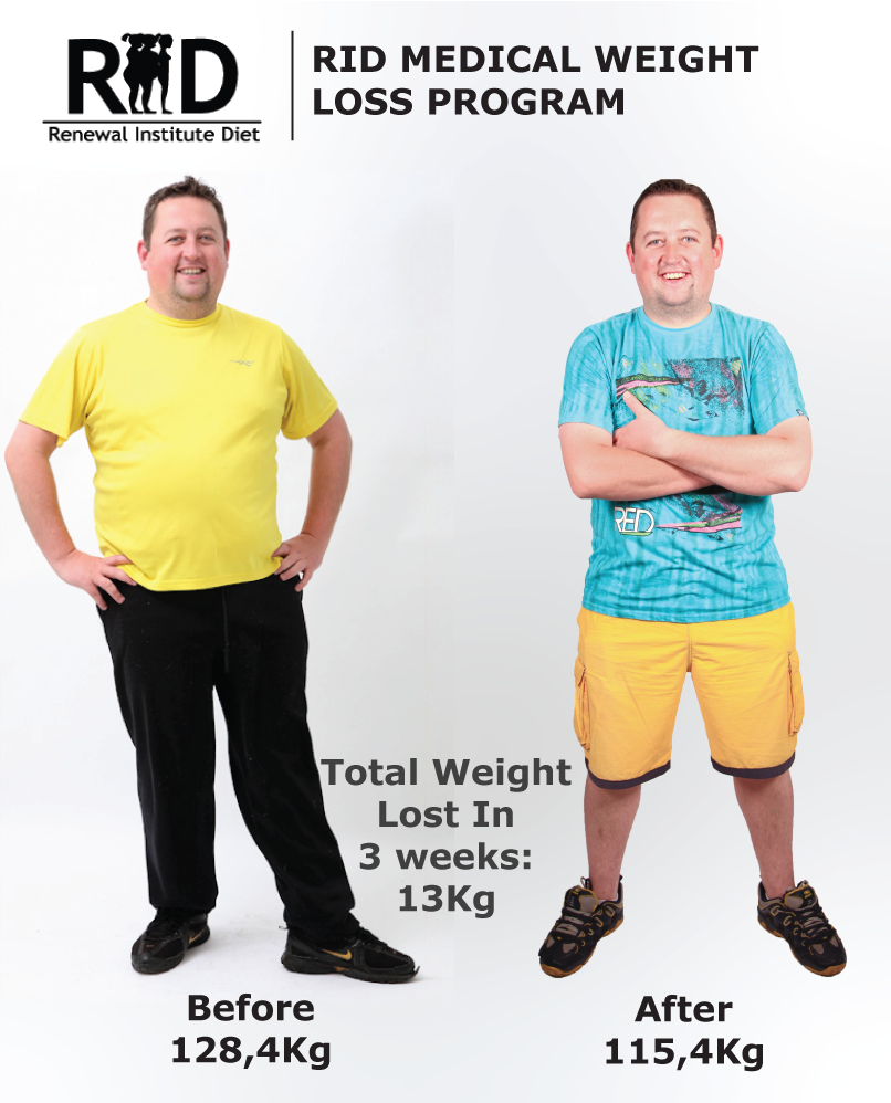 Rid Before And After Renewal Institute Diet Medical Hcg Weight Loss Male 22